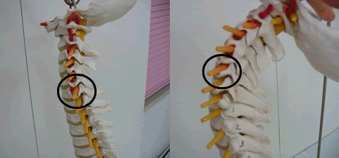 頚椎後屈 骨格模型の画像
