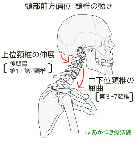 頭部前方偏位の頚椎の動き